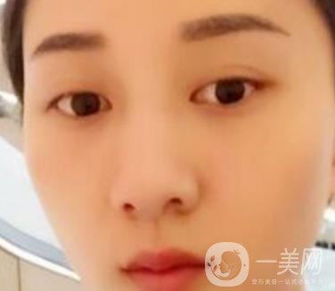 安醫(yī)一附院整形外科價(jià)格表2020版，還有激光祛斑案例