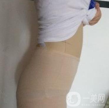 襄陽(yáng)市第一人民醫(yī)院整形美容科吸脂瘦肚子多少錢？?jī)r(jià)格表整形日記一覽