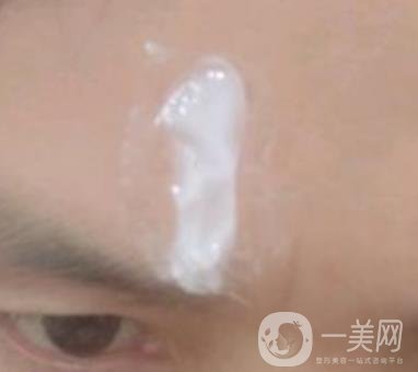 鄭大一附院祛疤怎樣?附2020整形價格表及案例*果圖