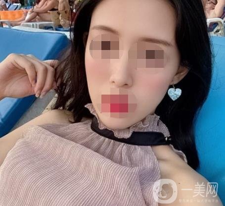 南大一附院整形美容科價(jià)格表2020版及祛疤案例