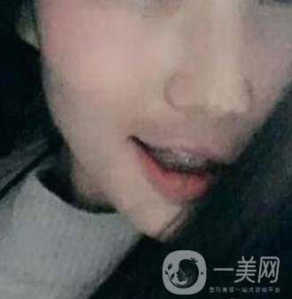 桂林美奧口腔醫(yī)院價(jià)格表全新版，附牙齒矯正案例