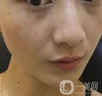 青醫(yī)附院整形美容科價格表及祛斑案例公布，速覽