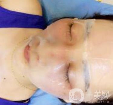 青醫(yī)附院整形美容科價格表及祛斑案例公布，速覽