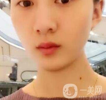 青醫(yī)附院整形美容科價格表及祛斑案例公布，速覽