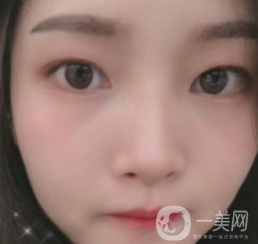 北京朝陽醫(yī)院整形中心紋眉*果怎么樣？價格價目表詳情一覽