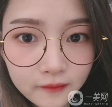 北京朝陽醫(yī)院整形中心紋眉*果怎么樣？價格價目表詳情一覽