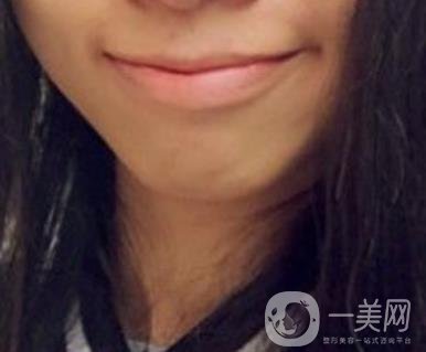 復(fù)旦大學(xué)附屬兒科醫(yī)院口腔科做牙齒矯正多少錢(qián)？?jī)r(jià)格表明細(xì)一覽