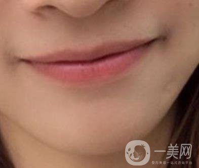 復(fù)旦大學(xué)附屬兒科醫(yī)院口腔科做牙齒矯正多少錢(qián)？?jī)r(jià)格表明細(xì)一覽