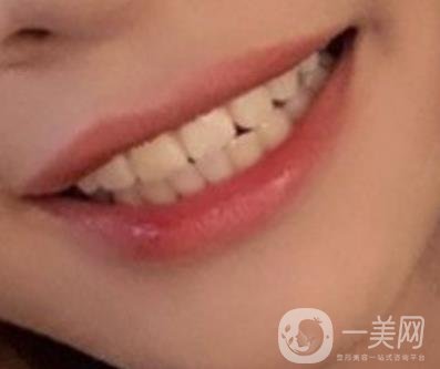 復(fù)旦大學(xué)附屬兒科醫(yī)院口腔科做牙齒矯正多少錢(qián)？?jī)r(jià)格表明細(xì)一覽