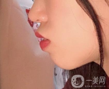 復(fù)旦大學(xué)附屬兒科醫(yī)院口腔科做牙齒矯正多少錢(qián)？?jī)r(jià)格表明細(xì)一覽