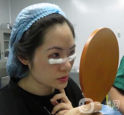 長(zhǎng)海醫(yī)院去眼袋