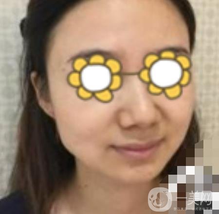 阜陽(yáng)市人民醫(yī)院整形美容科價(jià)格表2020版，附*案例