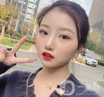 青島青醫(yī)附院整形價格表，還有雙眼皮實例