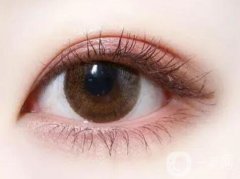 不太適合割雙眼皮的人群有哪些？