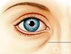 膠原蛋白填充淚溝的副作用有哪些?