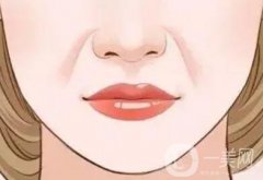 形成法令紋的原因是什么？