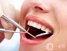 洗牙能美白牙齒嗎？洗牙對(duì)牙齒有害嗎？
