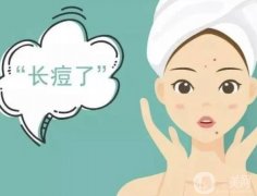 激光去痘印后如何處理抗黑?