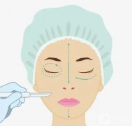 隆鼻后要忌口多久？哪些不能吃？