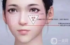 填充蘋果肌有哪些方法？