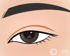 雙眼皮有哪些變寬的方法？