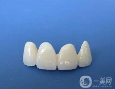 洗牙牙齒會松動嗎？怎么護理烤瓷牙？