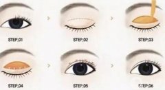 雙眼皮手術(shù)恢復(fù)需要多長時間？