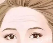 有抬頭紋的原因是什么？可以去掉嗎？