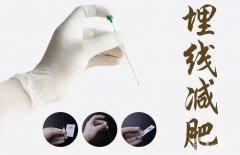 埋線減肥的風(fēng)險(xiǎn)有哪些？