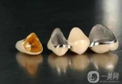 烤瓷牙的壽命怎么延長(zhǎng)?烤瓷牙的注意事項(xiàng)？