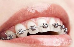 牙齒矯正去公立醫(yī)院好還是私立醫(yī)院好？