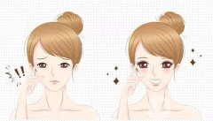 雙眼皮可以做第二次嗎？