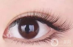 孕睫術是不是*性的？