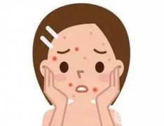 祛痘手術(shù)是否會留下疤痕，祛痘手術(shù)有沒有風(fēng)險(xiǎn)？