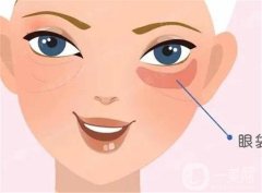 哪些因素影響去眼袋果的維持時間?