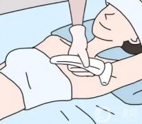 超冰脫毛的價格受哪些因素影響?