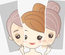 彩光嫩膚有什么果？對皮膚有什么傷害嗎？