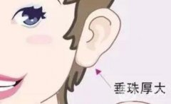豐耳垂有什么危害