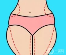 抽脂沒(méi)有瘦的原因是什么？如何控制體重?