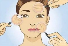 熱瑪吉的原理是什么，會灼傷皮膚嗎