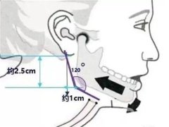 切骨好不好？有哪些危害？