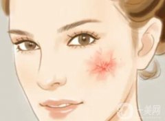 紅血絲去除手術(shù)要多少錢？