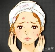 什么是激光祛斑調(diào)節(jié)，激光祛斑有什么風險？