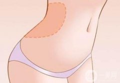 全身吸脂手術(shù)不適合哪些人？