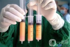 水動力吸脂的果*嗎？有哪些優(yōu)勢