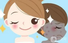 光子嫩膚的性怎么樣？