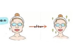 面部整形有哪項(xiàng)目？