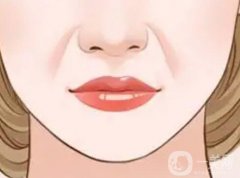 脂肪填充法令紋的價(jià)格是多少？