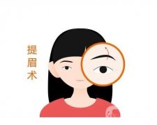 微創(chuàng)提眉術(shù)手術(shù)方法？微創(chuàng)提眉術(shù)的特點(diǎn)？