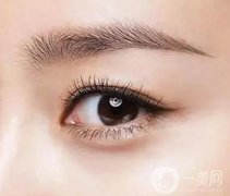 外眥成形術(shù)有哪些方法?